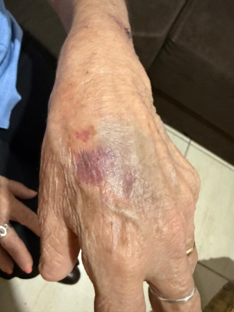 Mulher é presa por agredir mãe idosa e tenta morder policiais no Paraná